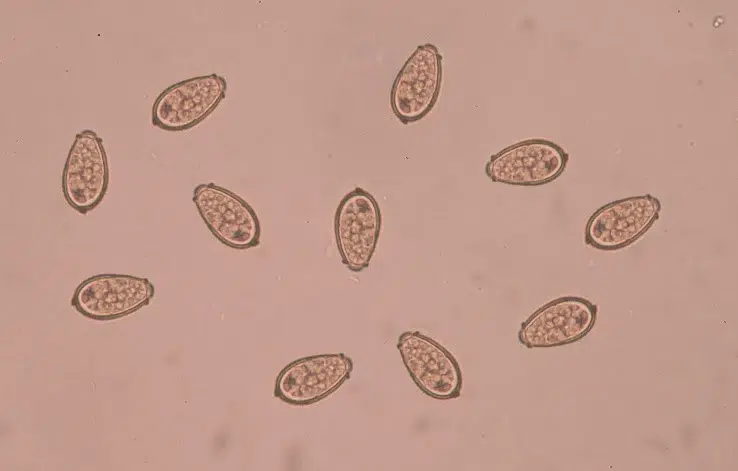 الديدان الكبدية (Liver Flukes)